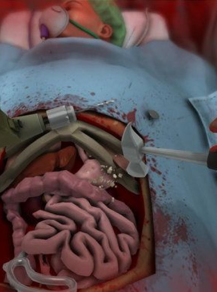 Surgeon Simulator 2013 Steam Key GLOBAL Surgeon Simulator 2013 Steam Key GLOBAL